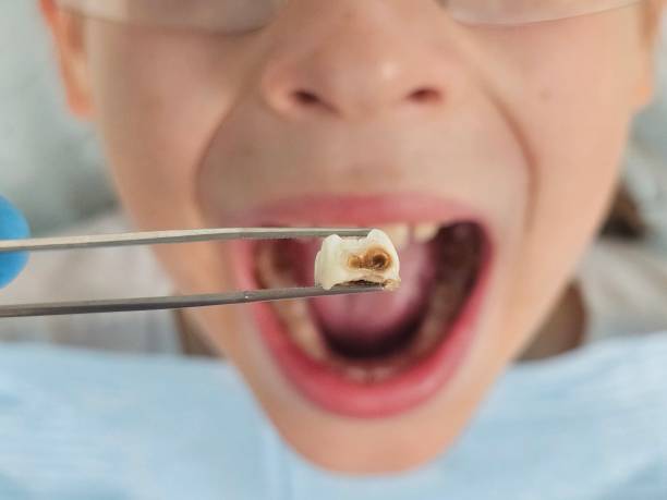 Best Emergency Broken Tooth Repair in Boothwyn, PA